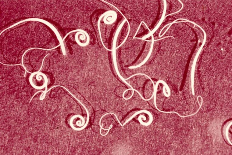 roundworms from the human body