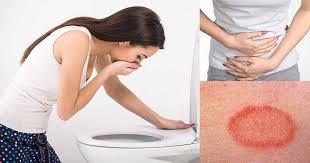 symptoms of parasites in the body