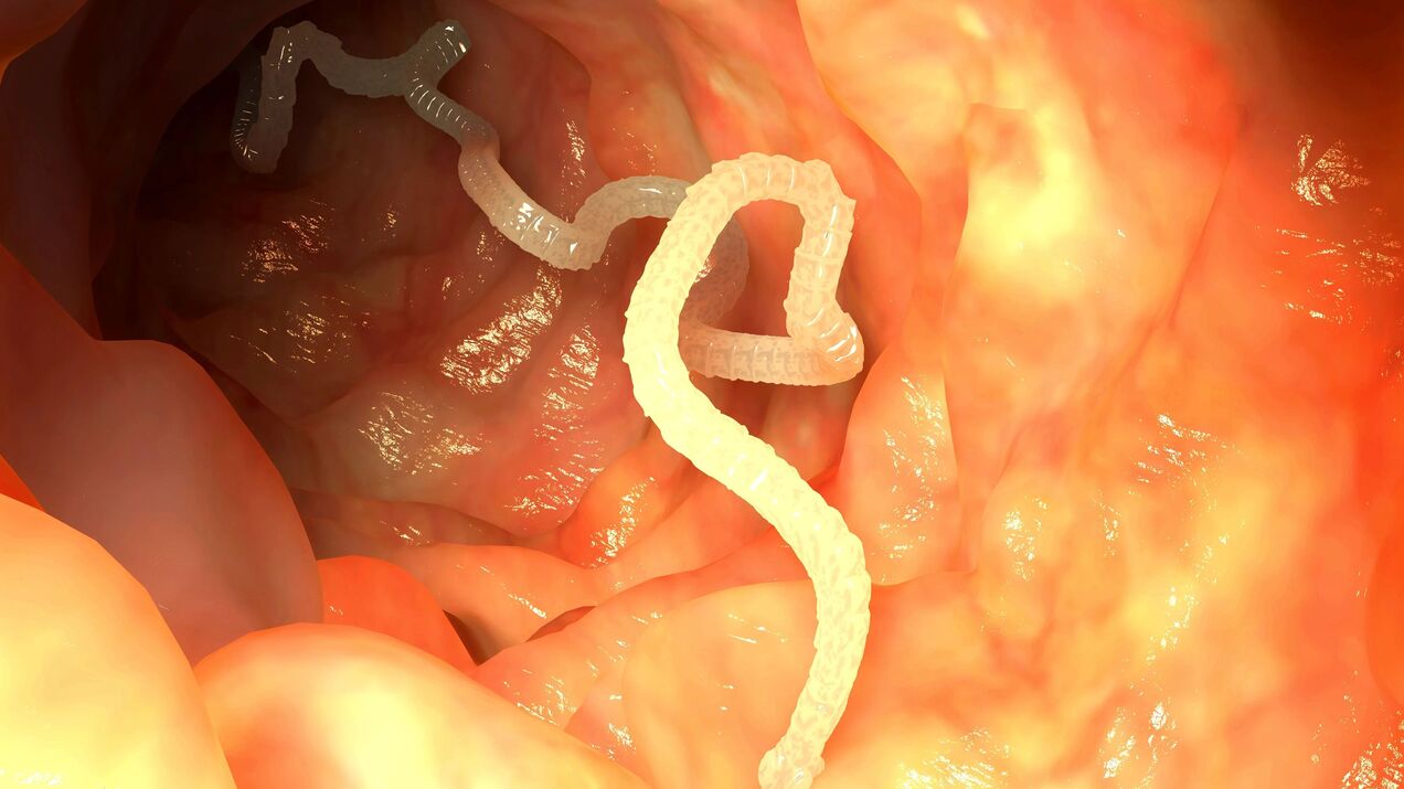 parasites in the intestines