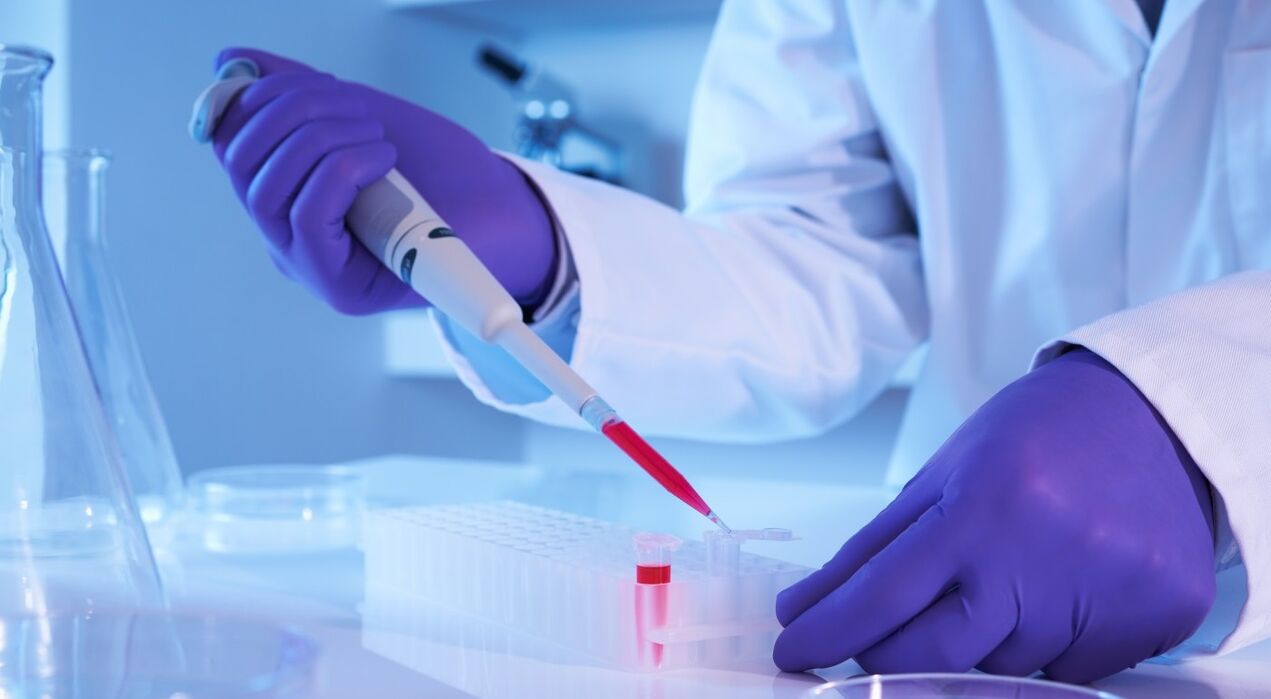 How to analyze parasites