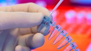 How to get tested for parasites