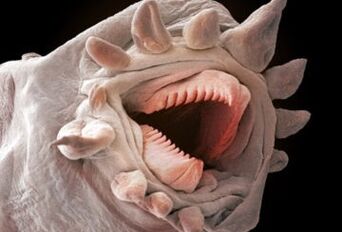 What kind of worms can live in the human body