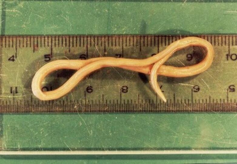 roundworm parasites from the human body