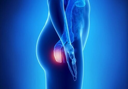 Itching in the rectum as an indication for parasitic testing