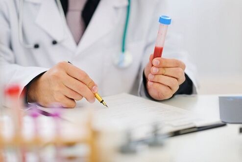 Parasite testing