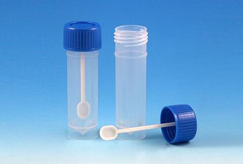 Vial for stool analysis to look for parasites