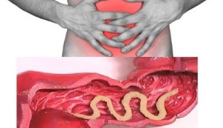 symptoms of the presence of the parasite in the human intestine