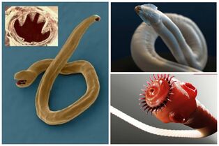 Types of worms