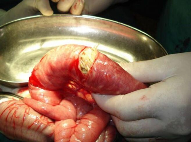 ches parasites are very dangerous for humans