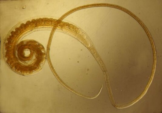 Trichinella worms from the human body